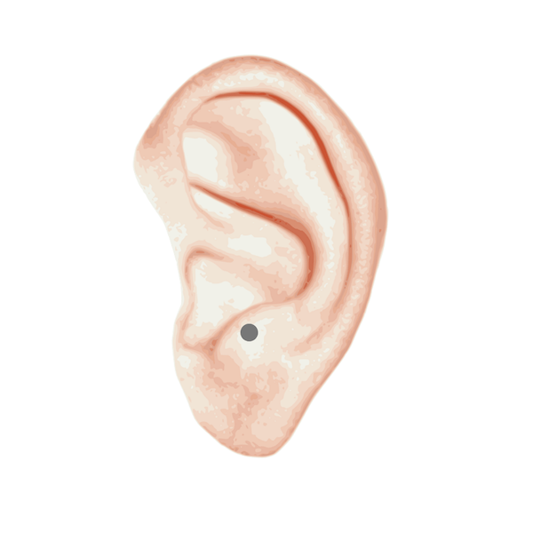 Anti-tragus piercing